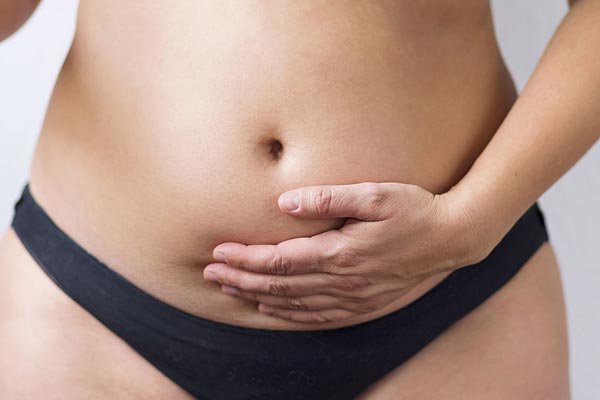 Mom with twins, c-section & diastasis